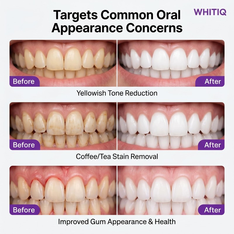 WHITIQ Purple Strips, Japanese Teeth Whitening Strips, White Strips for