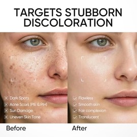 SKINTIFIC Crema humectante Dark Spot, hidratante iluminador, desvanece las manchas oscuras, hiperpigmentación, reparación de barrera de ceramida 5X, h