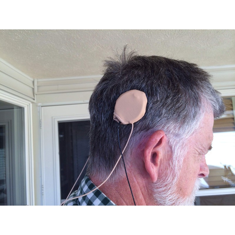 Ear Gear Rondo Cordless – Protect Implants from Dirt, Sweat,