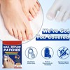 Extra Strength Fungal Nail Patches for Toenails & Fingernails, 32