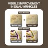 Kopher Crema Hidratante Hynical 360 Lifting Cream - 50ml