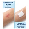 YIPFEN Waterproof Post-OP Plasters, Large, Pack of 40, Transparent, for