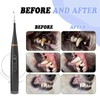 FZChenrry Dog Plaque Remover for Teeth, Dog Teeth Cleaning Kit