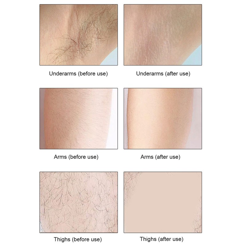 Electric Shaving Tool for Women USB Charging Cordless Hair Removal