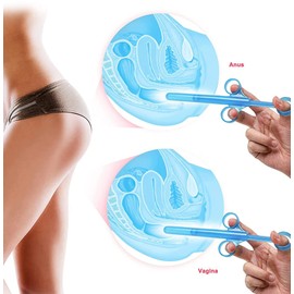 2Pcs Lube Applicator Syringes, Tube Launcher Shooter Reusable Lubricant Oil Injector Propeller Lube with Smooth Round Cap Syringes for Men Women Blue