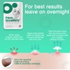 Face Invaders Acne Patches | Pack of 108 Translucent Hydrocolloid