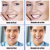 Tiras Blanqueadoras Dentales White Higiene Bucal