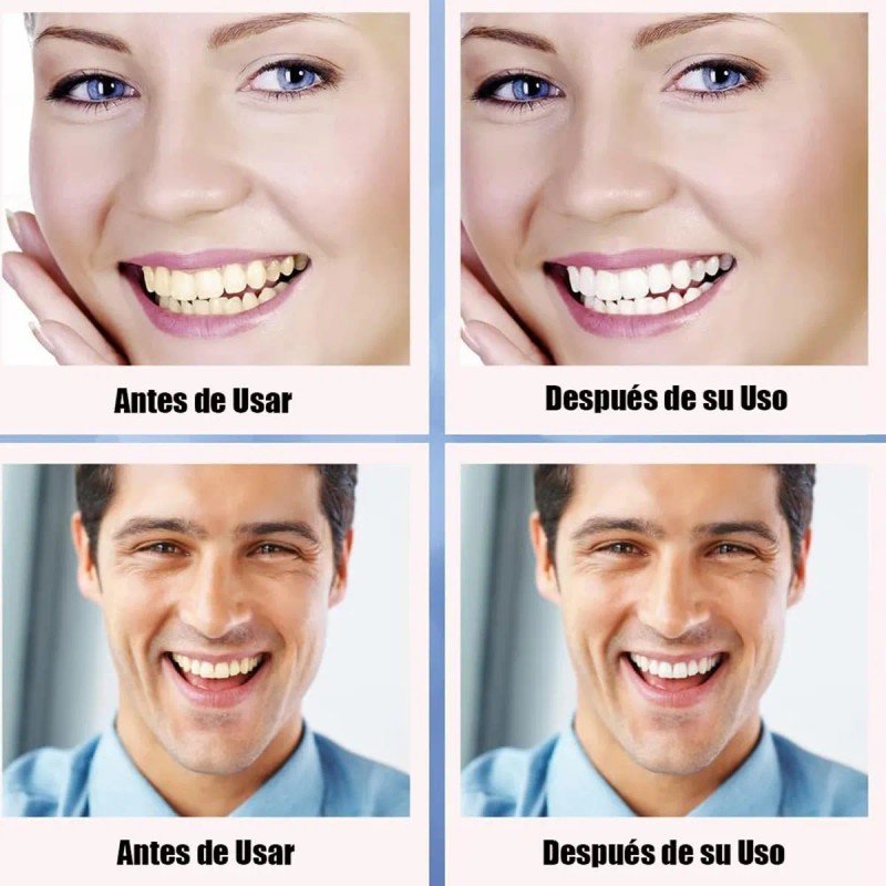 Tiras Blanqueadoras Dentales White Higiene Bucal