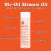 Bio-Oil® 6.7oz: Multiuse Skincare Oil