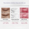 Crema Contorno Ojos Microcorriente| Péptido| Cafeína 20ml