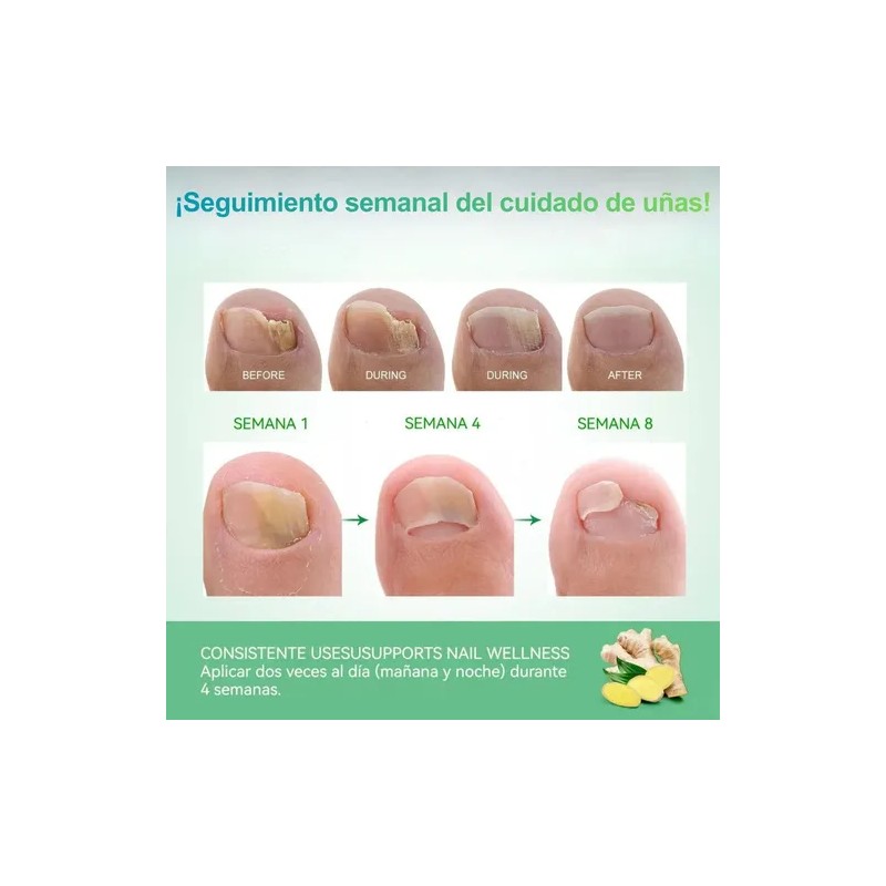 Parches Antimicóticos For El Tratamiento De Uñas