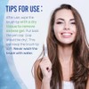 VieBeauti Teeth Whitening Pen (4 Pcs), 40+ Uses, Effective, Painless,