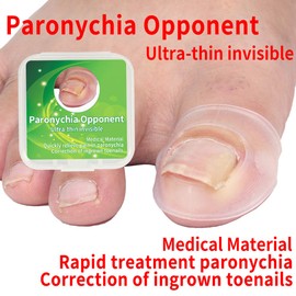 Ingrown Nail Corrector, 2Pcs Silicone Ingrown Toenail Correcting Tool Ingrown Nail Corrector Ingrown Toenail Corrector Paronychia Treatment for Ingrown Toenail