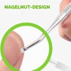 50 Pieces Nail Clips Set for Correction Ingrown Toenails, Toenail