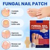 Pack of 42 Nail Fungus Plasters, Nail Patches, Nail Plasters,