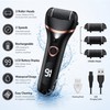 Electric Callus Remover for At-Home Pedicure – 2-Speed Rechargeable Foot