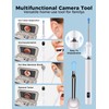 Sofbunny A03 Ear Wax Removal Tool Camera with Screen, Ear