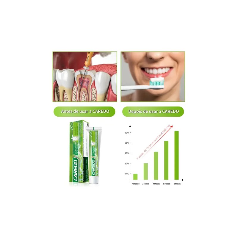 Caredo Toothpaste For Root Canal Autotherapy Mint 100ml