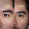 Blackbeard Antiojeras Roll-On para Ojos con Niacinamida, Ácido Hialurónico, Cafeína