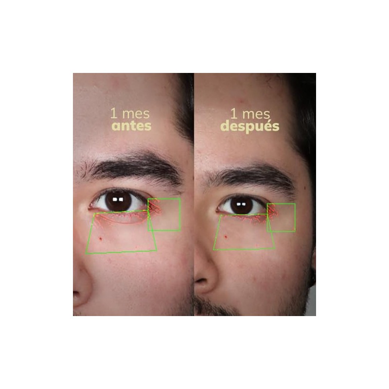 Blackbeard Antiojeras Roll-On para Ojos con Niacinamida, Ácido Hialurónico, Cafeína