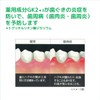 GUM(ガム)・デンタルペースト 155g (医薬部外品)