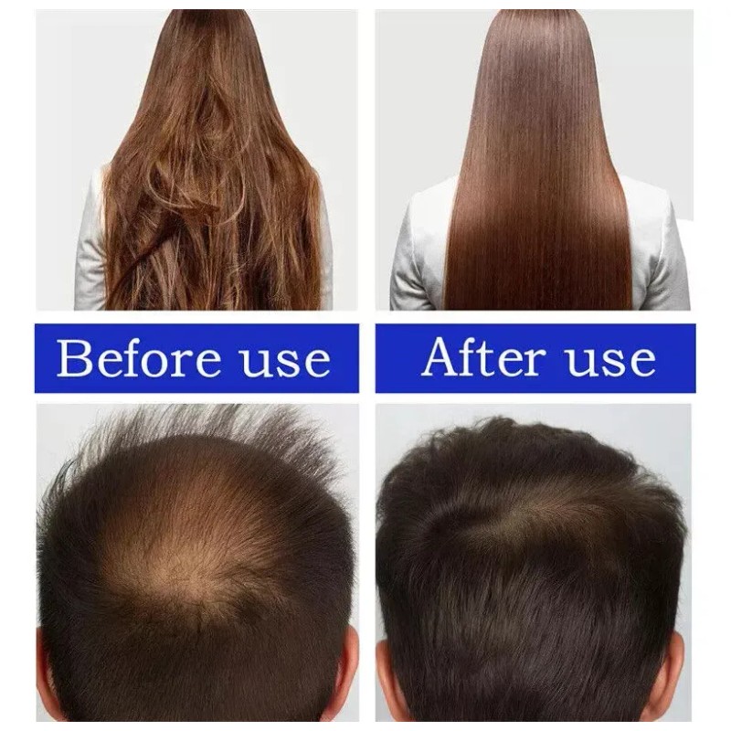 4pc Aceite De Batana Orgánico Para Realzar El Cabello, 60ml