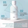 Pyunkang Yul [Pyunkang Yul]ACNE Toner 150ml + ACNE Spot Patch