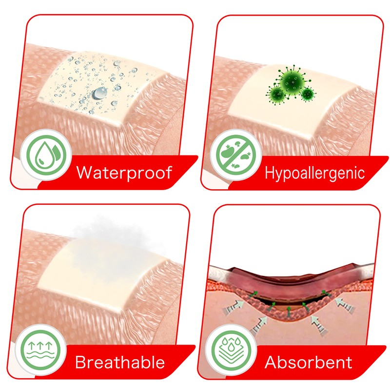 FRESINIDER 2" x 5" Pack of 10 Silicone Foam Wound