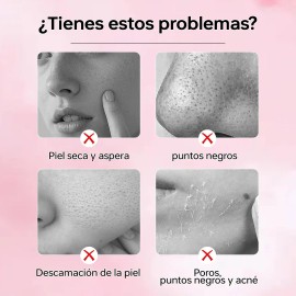 Gel Exfoliante Facial Purificador Profundo De Nicotinamida