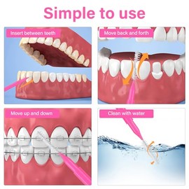 Healeved Cepillos Interdentales Para Brackets De Frenos Para Limpiador 100 Uds Interdental De Hilo Bucal Hilo Herramienta De Limpieza De Limpiador De 