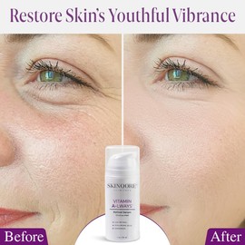 3.5% Retinol Serum for Face | Dark Spot Remover and Vitamin A Wrinkle Cream | Anti Aging Serum | Hyaluronic Acid Serum Moisturizer | Redness Reducing Skin Care Night Cream | Natural Skincare - 1 Oz