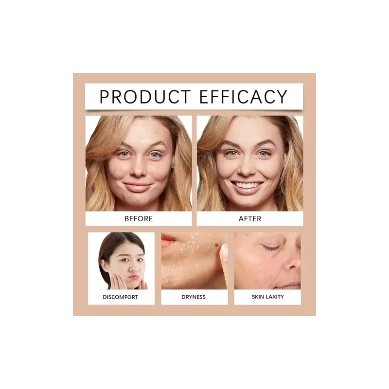 Crema Facial Calmante Con Centella Asiática Para Pieles Sens