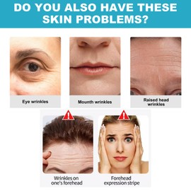 MrCuvaryas 160PCS Face Patches For Wrinkles Overnight, Face Tape For Wrinkles Wrinkle Patches For Face Overnight, Wrinkle Tape For Face, Forehead Wrinkle Facial Wrinkle Patches Face Lift Tape