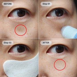 Set De 6 Parches De Colgeno Hidrogel Y Srum Hidratante Roll On Para Ojeras E Hinchazn Srum Coreano Para Ojos Con cido Hialurnico Y Cafena