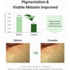 Dr.Althea Gentle Vitamin C Serum