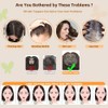 Hair Toppers for Women with Thinning Hair Toppers 360° 3D