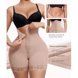 FeelinGirl Fajas Colombianas Shapewear for Women Post Surgery Compression Garment Tummy Control Shaper with Zipper Crotch, Rose Gold, Medium