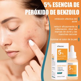 Sérum Peróxido Benzoilo 5% Eliminar La Cabeza Negra Del Acné