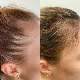 Aede Aéde Hair Activist Hair Skin and Nail Supplement 180 Tablets - 3 Month Supply