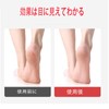 Bookwarm pumice stone for feet, natural pumice stone for exfoliation,