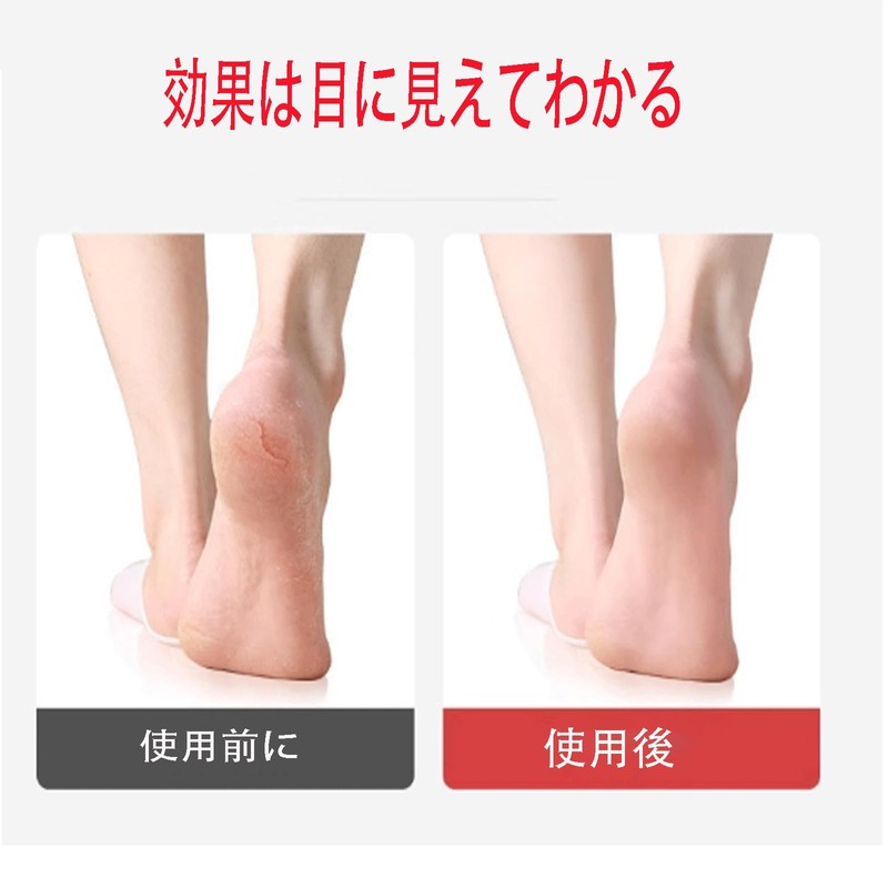 Bookwarm pumice stone for feet, natural pumice stone for exfoliation,