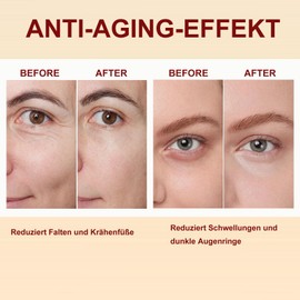 Augencreme mit 4% Retinal Liposom, Fermentierte Bohne, Anti-Aging Augenserum Gegen Augenringe, Tränensäcke, Falten, Augenringe Entfernen Sofort - Augenpflege für Frauen