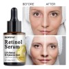 Mopoyat Retinol Facial Essence 30ml