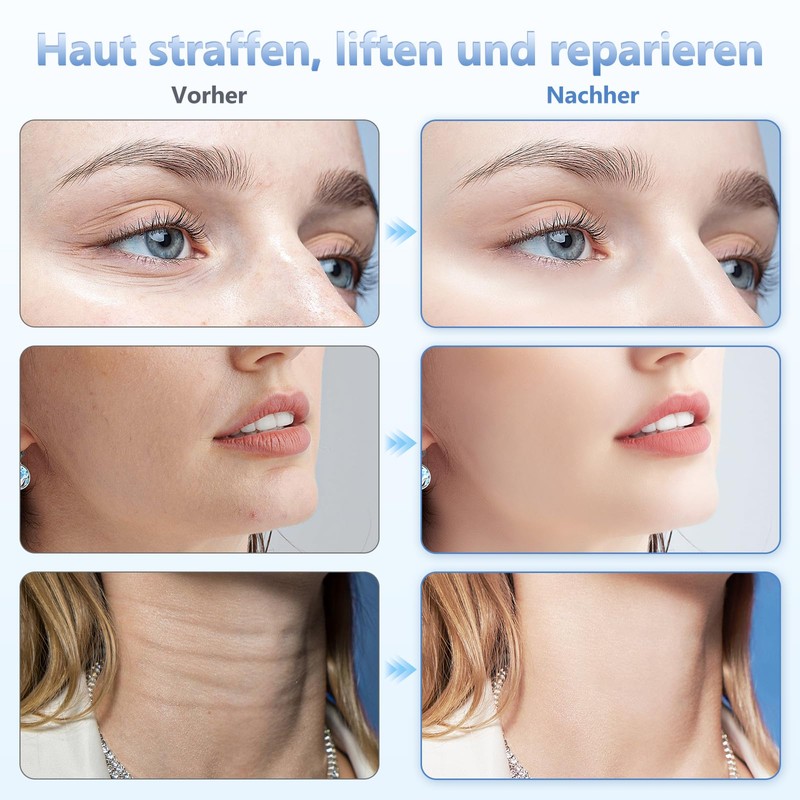 Electric Face Massager Anti-Wrinkle