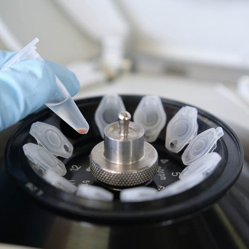 BKMAMLAB - Tubos de microcentrífuga de 1,5 ml, 500 unidades,