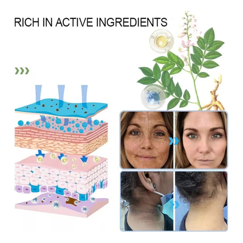 1pc Gel Exfoliante Purificante Quarxery Exfoliantequarxery