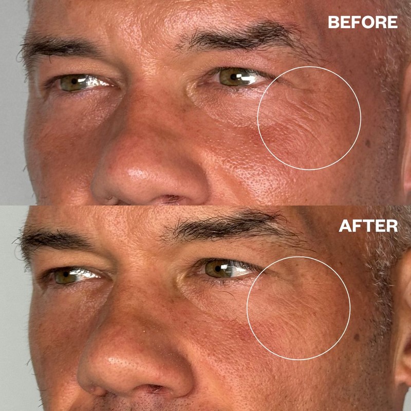 Wrinkles Schminkles Men's Pro Eye Wrinkle Patches - 1 Pair