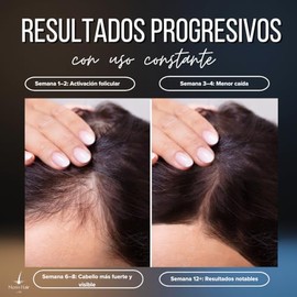 Shampoo de Bergamota con Minoxidil al 7 Shampoo anti caída 500 ml Mens Hair Lab Libre De Sulfatos y Parabenos Regeneración Capilar Con Aceite de Coco 