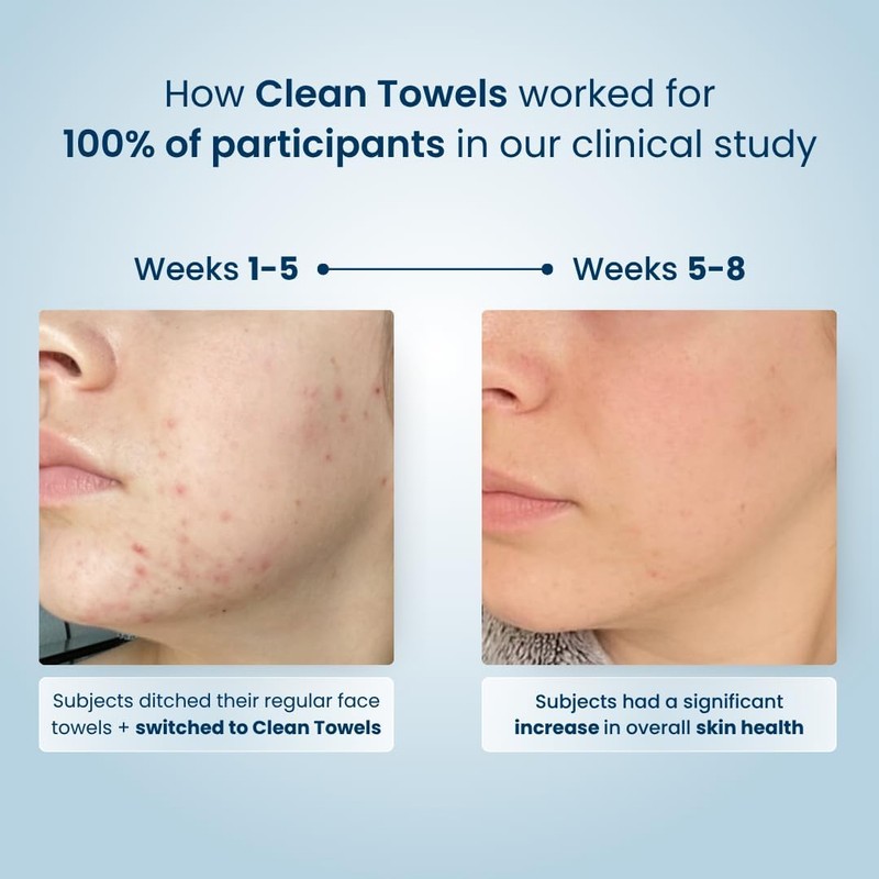 Clean Skin Club Clean Toalla Pequeña (4 pack)