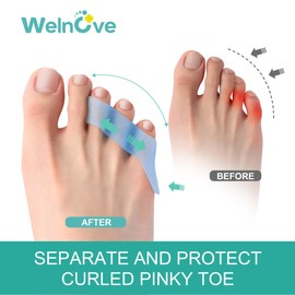 Welnove 12-Pack Gel Pinky Toe Separators - Little Toe Spacers & Cushions, Small Toe Sleeves for Reducing Pressure and Preventing Rubbing (Blue)